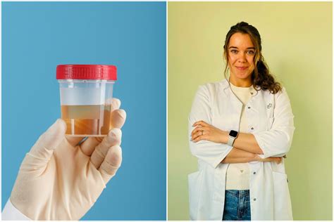 Šlapimo tyrimo mėginio paėmimas