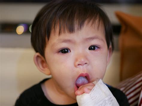 Vaiko karščiavimo simptomai