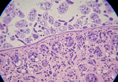 infografika apie rėmens priežastis ir prevenciją nėštumo metu