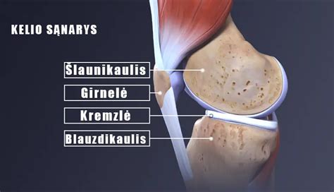 schema kaip tinkamai užsidėti kelio apsaugas
