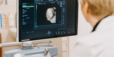 Schematinis vaisiaus vystymosi pavaizdavimas