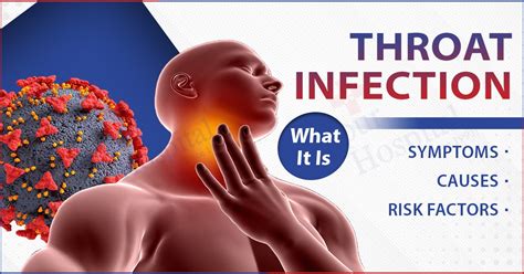 schema of throat infection causes and treatments