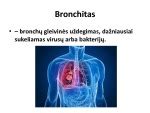 Schema: Ūminio bronchito diagnostika ir gydymas