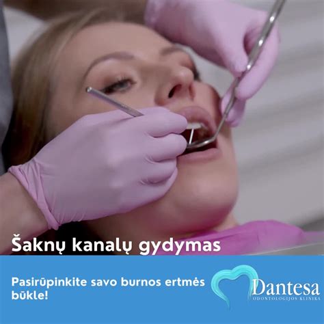 schematinis danties pūlinio vaizdas