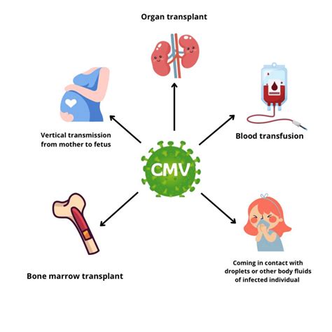 diagram illustrating CMV transmission and effects