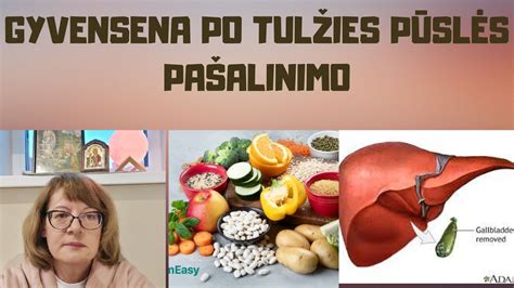 Tulžies pūslės ir kepenų schema
