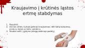 Implantacijos kraujavimo pavyzdžiai