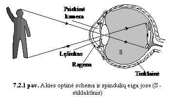 Schema, vaizduojanti akies refrakcijos ydas