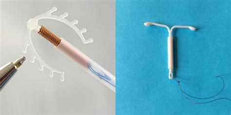 Grafikas, rodantis hormoninės spiralės efektyvumą palyginti su kitomis kontracepcijos priemonėmis