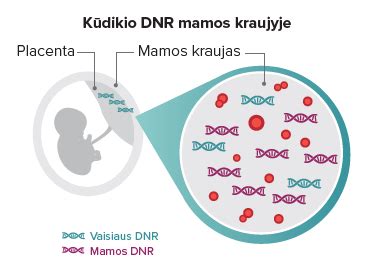 Schematinis vaisiaus DNR tyrimas iš motinos kraujo