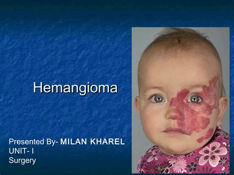 kūdikis su hemangioma