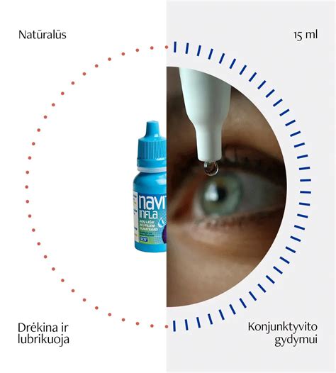 schematinis akių konjunktyvito tipų palyginimas