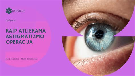 scheminis astigmatizmo paaiškinimas