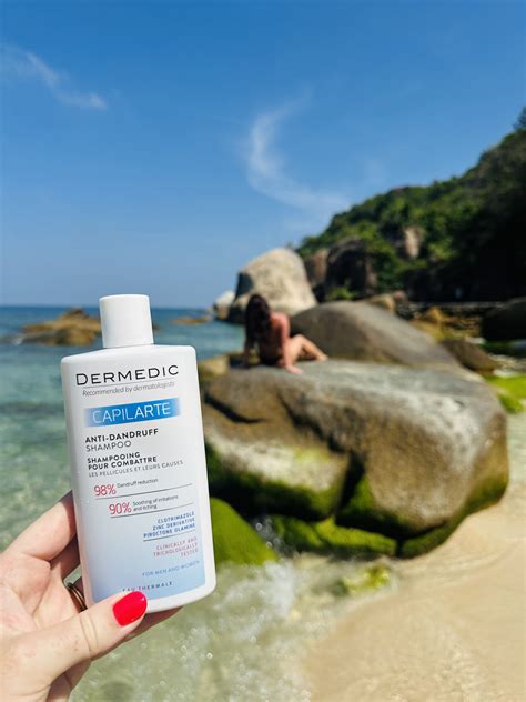 Riebių pleiskanų pavyzdys