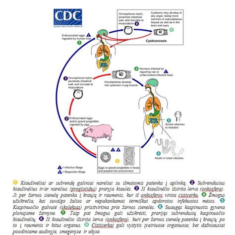 Scheminė atvaizdavimas, kaip skrandžio rūgštis patenka į stemplę