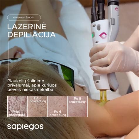 Lazerinio pigmentacijos šalinimo principas