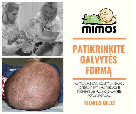 Kūdikio galvytės matavimas kraniometru
