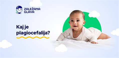 Schematinis vaizdas: Plagiocefalija