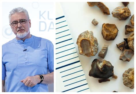 Schema, kaip susidaro inkstų akmenys