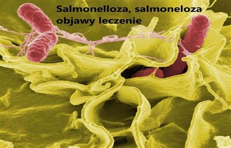 Salmoneliozės bakterija
