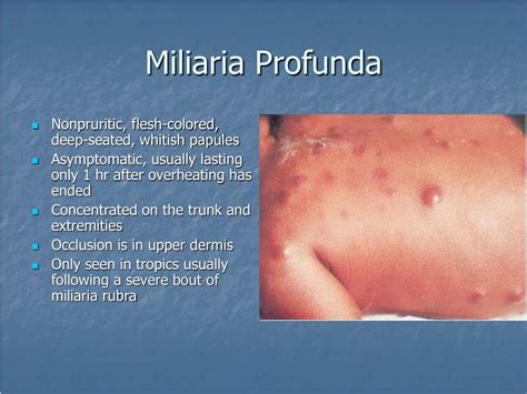 Nuotrauka: Miliaria profunda - gilesni, skausmingi mazgeliai