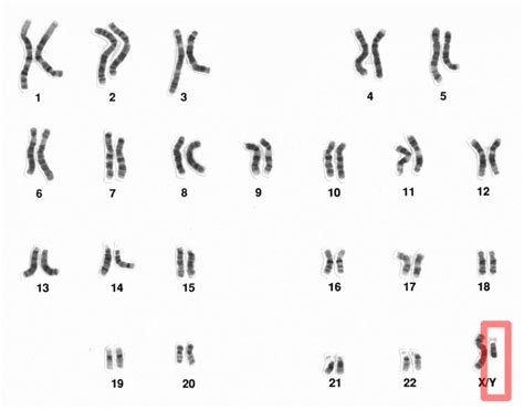 Žmogaus chromosomos