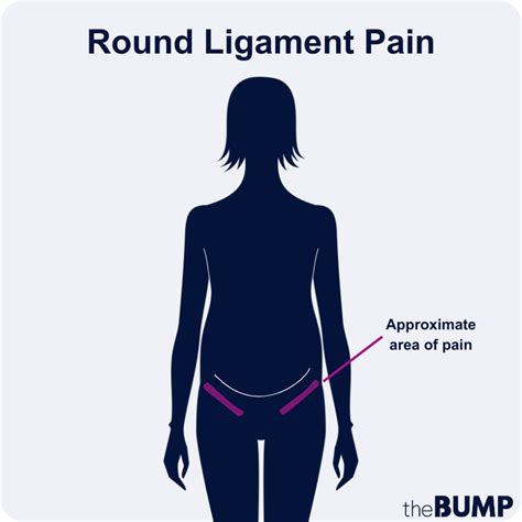 schema of round ligament pain in pregnancy