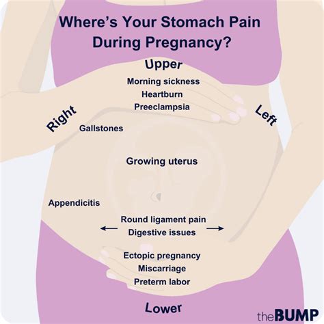 common causes of abdominal pain in pregnancy chart