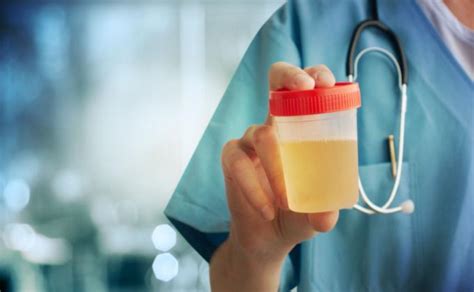 Schema, kaip atliekamas bendras šlapimo tyrimas