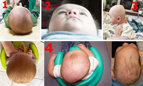 Kūdikis ant keturių, besiruošiantis ropoti