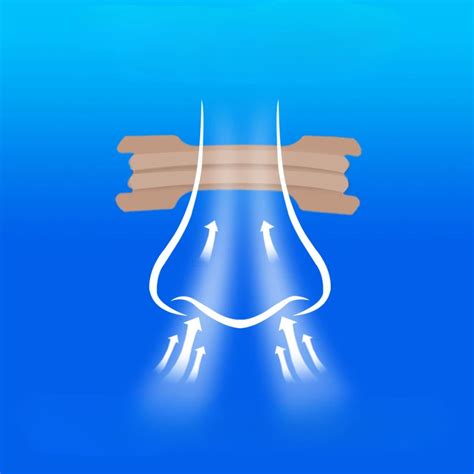 Schema kaip veikia nosies gleivių atsiurbiklis