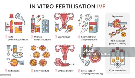 In vitro fertilizacijos (IVF) procedūros schema