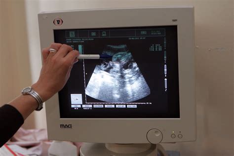 Schema apie ultragarsinius tyrimus nėštumo metu