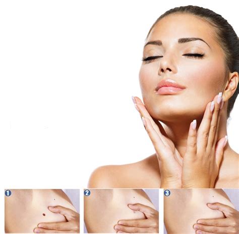 Apgamų tipai ir jų priežiūra