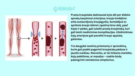 Liaudiški vaisiaus lyties spėjimo būdai