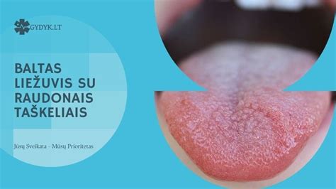 Liežuvio anatomija su papilėmis