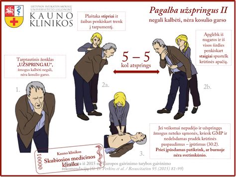 Infografika: Veiksmai užspringus kūdikiui