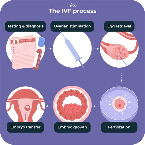 IVF embriono perkėlimo procesas