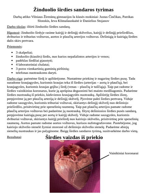 Schematinis krūties sandaros pavaizdavimas