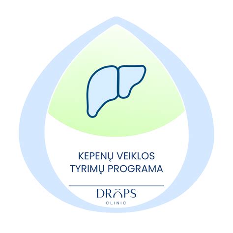 Kepenu veiklos schematinis pavaizdavimas