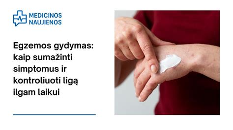 Scheminis egzemos simptomų vaizdavimas