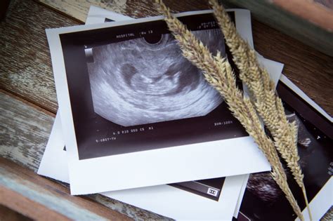 Ultragarso nuotrauka, rodanti placentos pirmeigos tipus