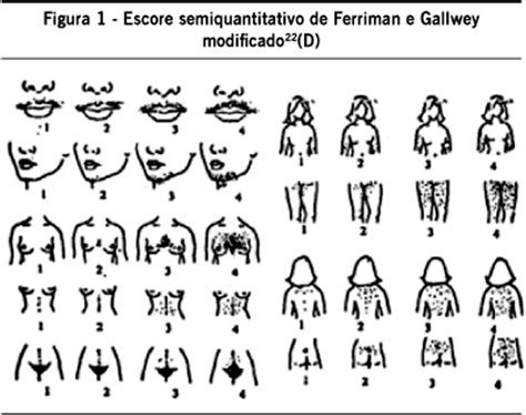 Ferriman-Gallwey skalė