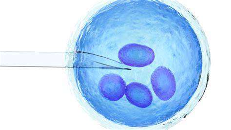 Schematinis IVF procedūros pavaizdavimas