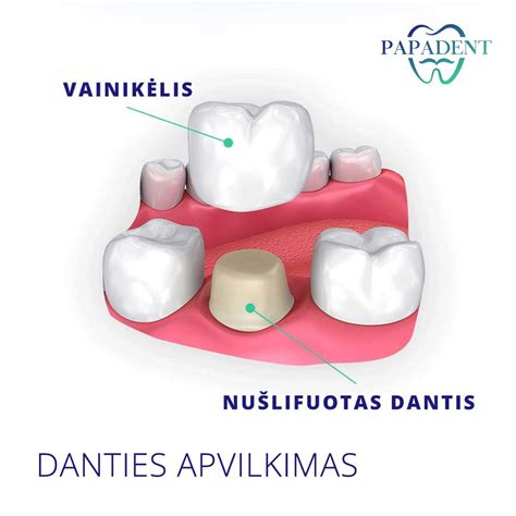 danties pūlinio schema