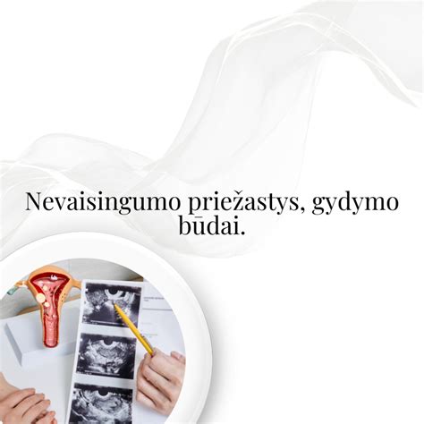 Simbolinis vaizdas, vaizduojantis moters nevaisingumo gydymo procesą