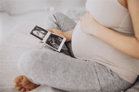 Vitamino A šaltiniai ir jo perteklius nėštumo metu