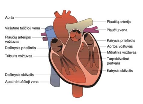 Schema kaip veikia širdis su prieširdžių pertvaros defektu