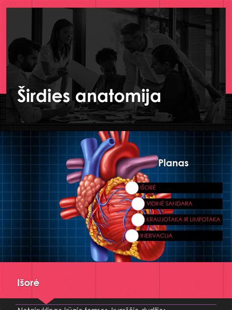 Schematinis žmogaus širdies vaizdas su išvardintomis įgimtomis ydų rūšimis