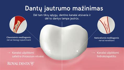 Simptomų, tokių kaip kraujuojančios dantenos, iliustracija